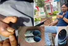Photo of बेंगलुरु में दर्दनाक हादसा: चप्पल में छिपे सांप के काटने से सॉफ्टवेयर इंजीनियर की मौत